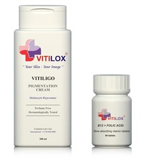 Vitiligo Vitilox Pigmentation Cream & Vitilox Vitamins B12 & Folic Acid