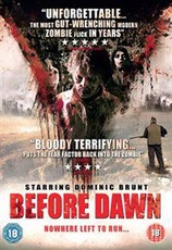 Before Dawn(DVD)